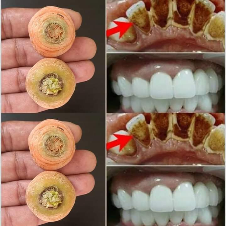 Improve Your Smile Naturally with Carrot Ends: An Easy Home Solution for Whiter Teeth